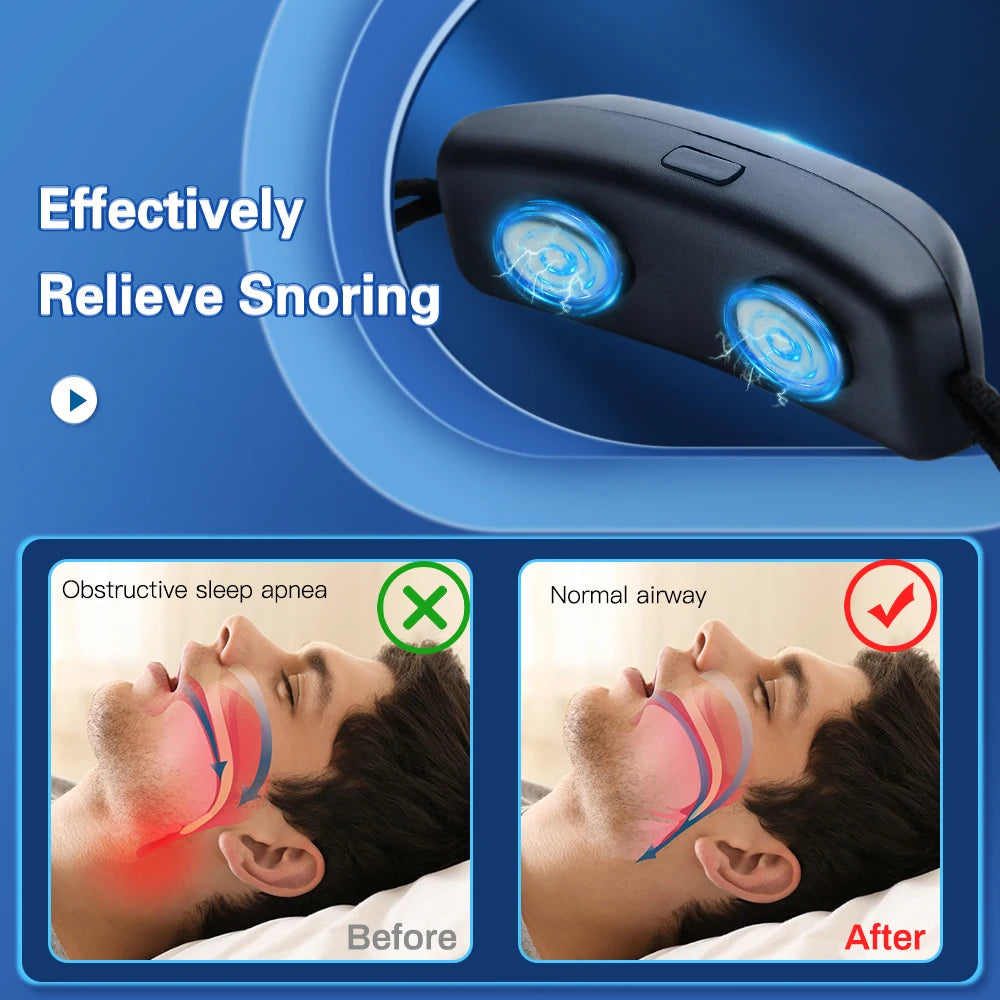 HushWave – Dispositivo antirronquidos EMS